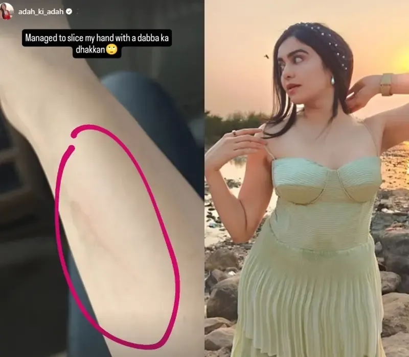 Adah Sharma Hilariously Injures Hand with Container Lid