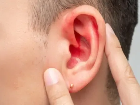 अदरक और सेंधा नमक से बना तेल कानों के दर्द से आराम दिलाने में है प्रभावी, जान लें प्रयोग से पहले की सावधानी