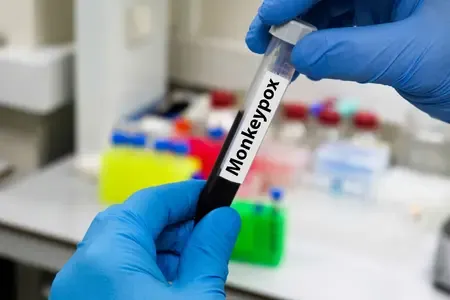What Actions is Africa CDC Taking to Combat the Mpox Outbreak in Southern Ethiopia?