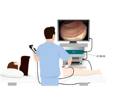 AI-assisted colonoscopies may raise deskilling risk among doctors: The Lancet