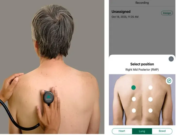 Can AI-powered digital stethoscopes bridge screening gaps?