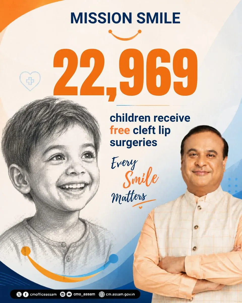 Assam Govt Completes 22,969 Cleft Lip Surgeries for Children