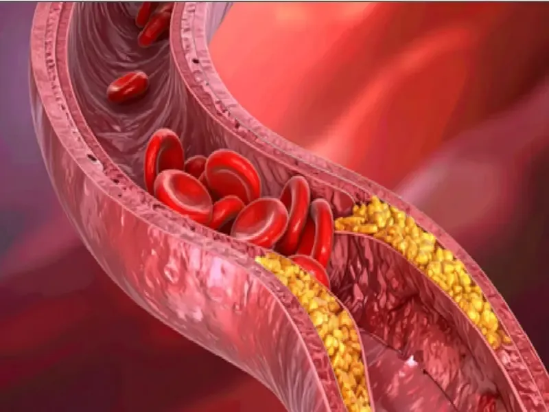क्या आयरन की कमी से शरीर बेजान होने लगता है? अच्छे स्वास्थ्य के लिए रोजाना कितनी मात्रा जरूरी?