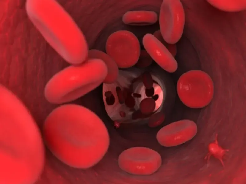 क्या आयुर्वेद के 3 उपाय एनीमिया की समस्या को दूर कर सकते हैं?