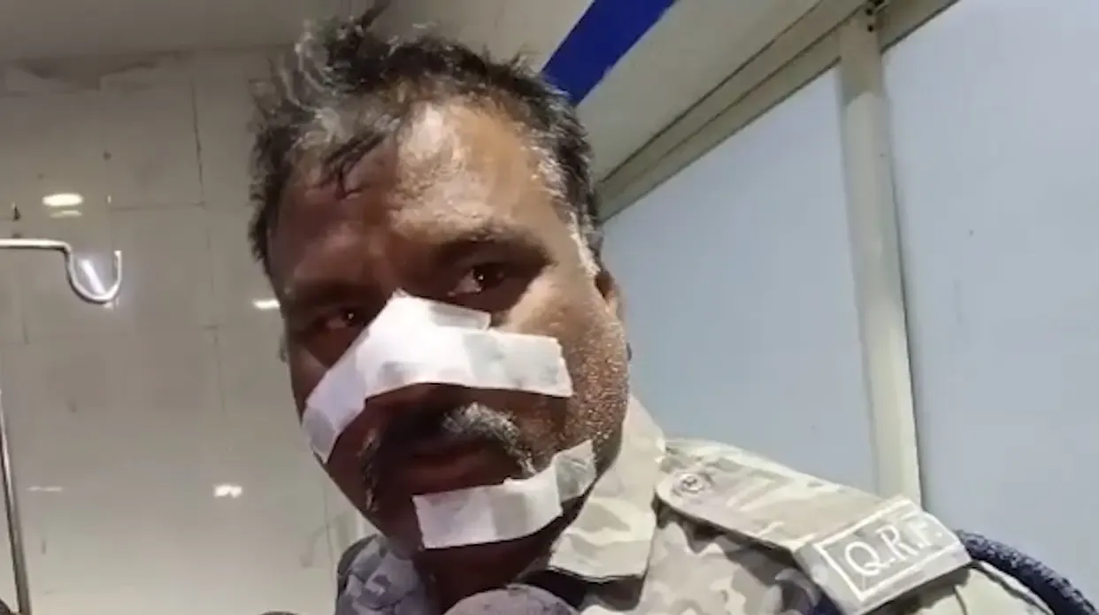 मध्य प्रदेश: टीम इंडिया की जीत का जश्न, पटाखे फोड़ने से पुलिसकर्मी घायल