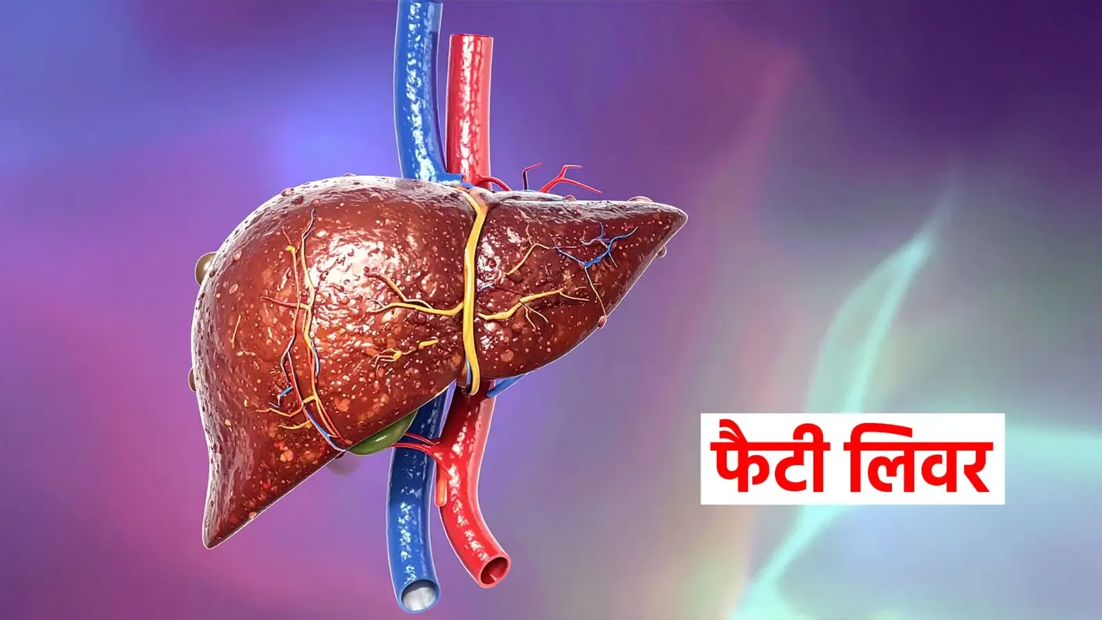 क्या फैटी लिवर एक गंभीर समस्या है? जानें इन आयुर्वेदिक उपायों से कैसे मिलेगा छुटकारा