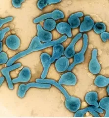 What is the latest on Ethiopia's Marburg outbreak as the death toll rises to five?