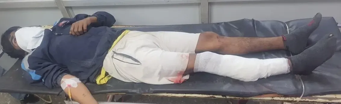 क्या दिल्ली में पुलिस और बदमाश के बीच मुठभेड़ हुई?