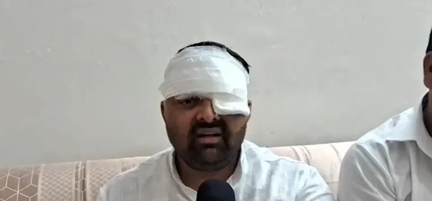 मेरठ SSP पर थर्ड-डिग्री टॉर्चर का आरोप: दिग्विजय भाटी बोले — 'लात से आंख फोड़ी, 30% ही ठीक होगी'