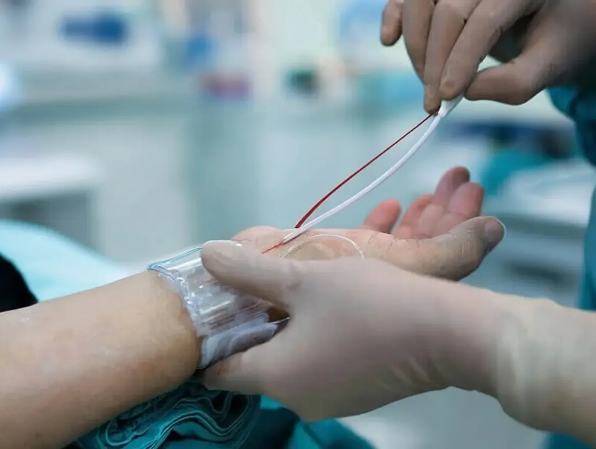 क्या दिल की सेहत के लिए एंजियोग्राफी जरूरी है? जानिए यह टेस्ट और इसके सावधानियां