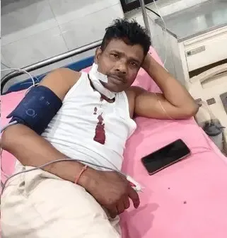 Excise Officer Injured in Attack During Raid on Illegal Liquor Unit in Jharkhand's Chaibasa