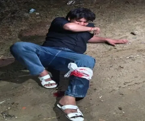 गाजियाबाद पुलिस ने मुठभेड़ में शातिर लुटेरे को किया गिरफ्तार, पैर में लगी गोली