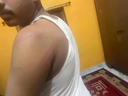 गिरिडीह: पचंबा थाने में BJP कार्यकर्ता की पिटाई का आरोप, बाबूलाल मरांडी ने माँगी थाना प्रभारी पर तत्काल कार्रवाई