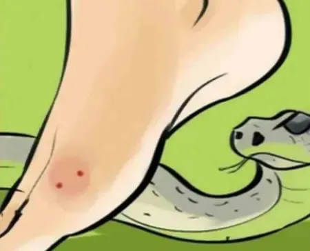Will Gujarat Introduce State-Specific Anti-Venom from Local Snake Venom to Save Lives?