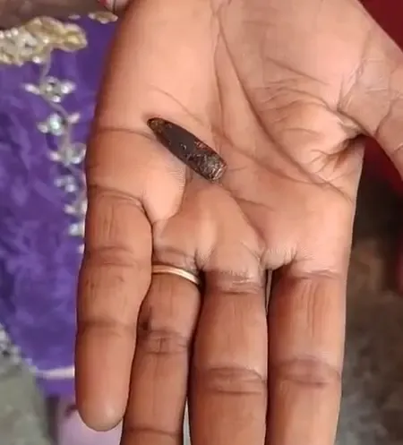 हरियाणा: 12 साल की बच्ची को लगी थी एसएलआर की गोली, 32 साल की उम्र में चला पता 