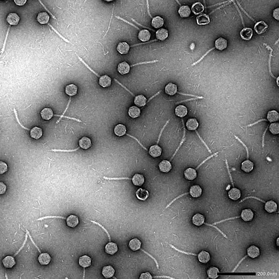 Could a Hidden Virus Help Combat Pneumonia-Causing Germs?