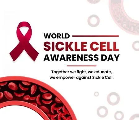 सिकल सेल बीमारी का पता लगाने के लिए 5.72 करोड़ लोगों की हुई स्क्रीनिंग: स्वास्थ्य मंत्रालय