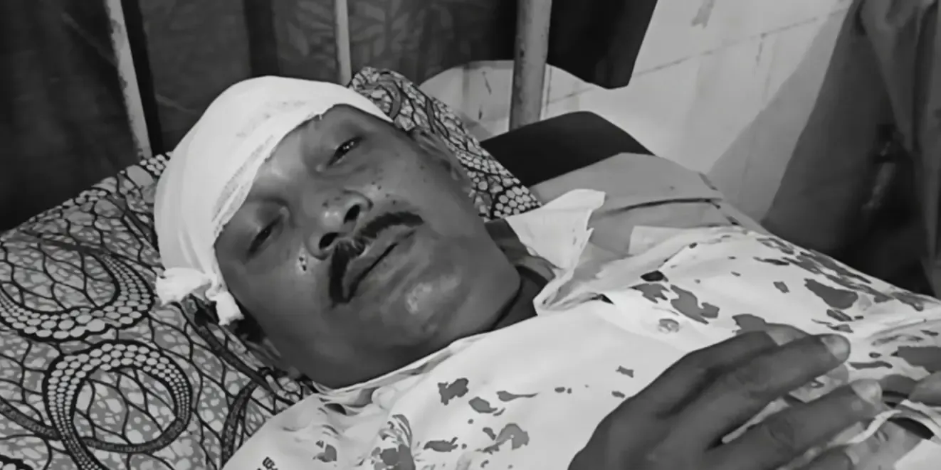 पश्चिम बंगाल चुनाव 2026: टीएमसी पर हमले का आरोप, भाजपा पोलिंग एजेंट बोले — 'सिर पर रॉड से मारा'