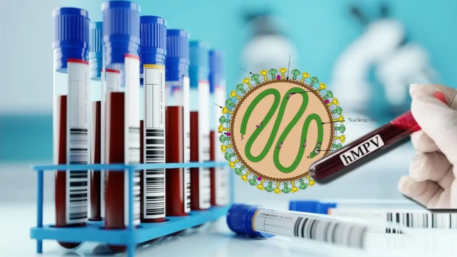 HMPV: Central Government Calls on States to Enhance Surveillance of Respiratory Ailments