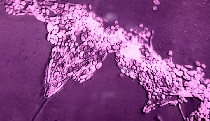 How Are ICMR Researchers Tackling Fungal Pathogens?