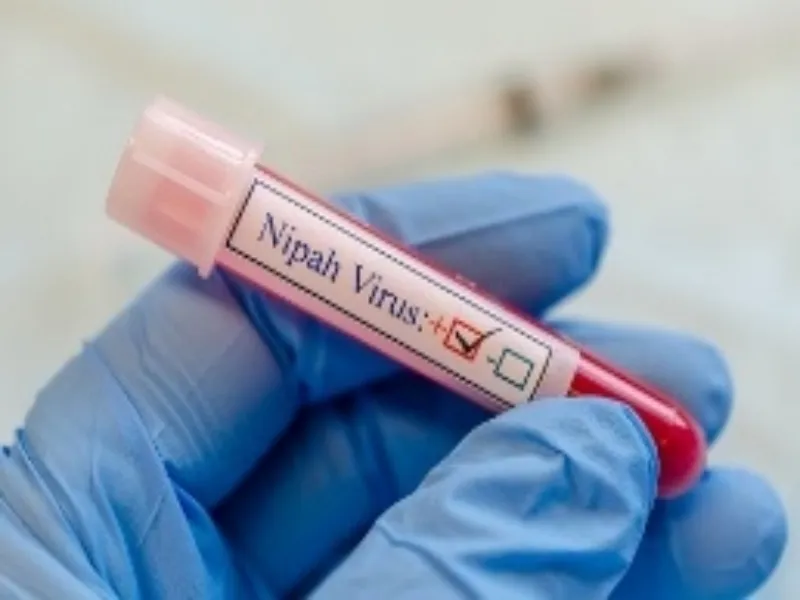 Is There a Nipah Virus Threat in Kerala?