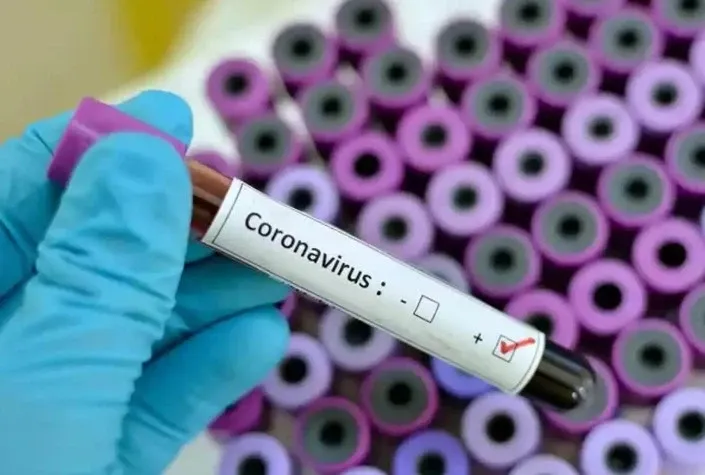 Should Karnataka Worry About Covid-19 Testing Kit Shortages?