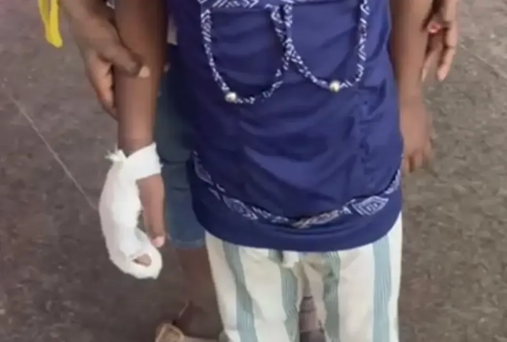What Happened in K’taka School: FIR Filed Against BEO and Teachers After Class 1 Student Loses Fingers?