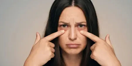 लगातार आंखों की सूजन को नजरअंदाज करना जोखिम भरा, हो सकता है किडनी से जुड़ी बीमारी का शुरुआती संकेत