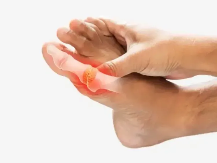 क्या 'आम' है गठिया की मुख्य वजह? जानें आयुर्वेद से बचाव के उपाय