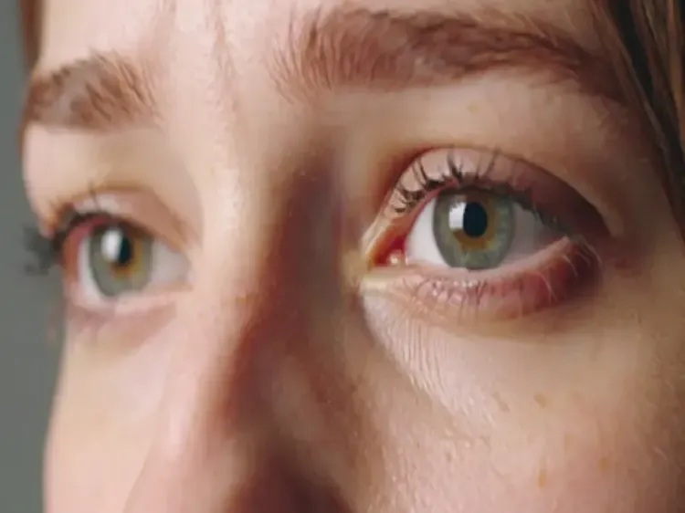 आंखों में केमिकल रंग चला गया है? जानें देखभाल के उपाय
