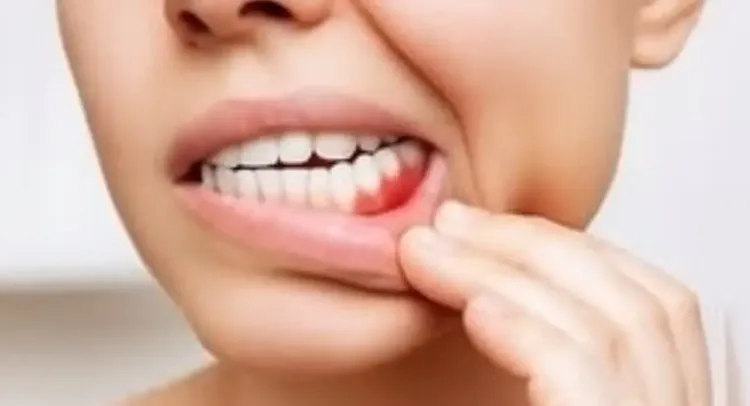 क्या दांतों में तेज झनझनाहट और दर्द से छुटकारा पाने के लिए घरेलू नुस्खे मदद करेंगे?