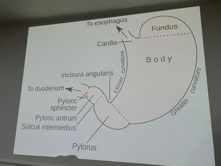 Can Metabolic Surgery Prevent Organ Damage From Uncontrolled Diabetes?