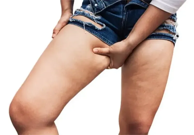 क्या आप मोटी जांघों से परेशान हैं? ये योगासन चर्बी कम करने में मदद करेंगे