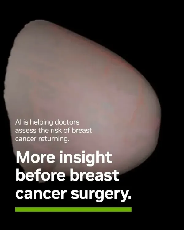 Nvidia-Powered AI Tool Helps Predict Breast Cancer Return