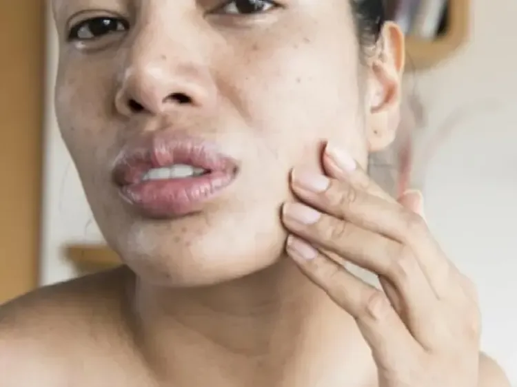 क्या अधूरी नींद है झुर्रियों का असली कारण? जानें समय से पहले मुरझाती त्वचा का रहस्य