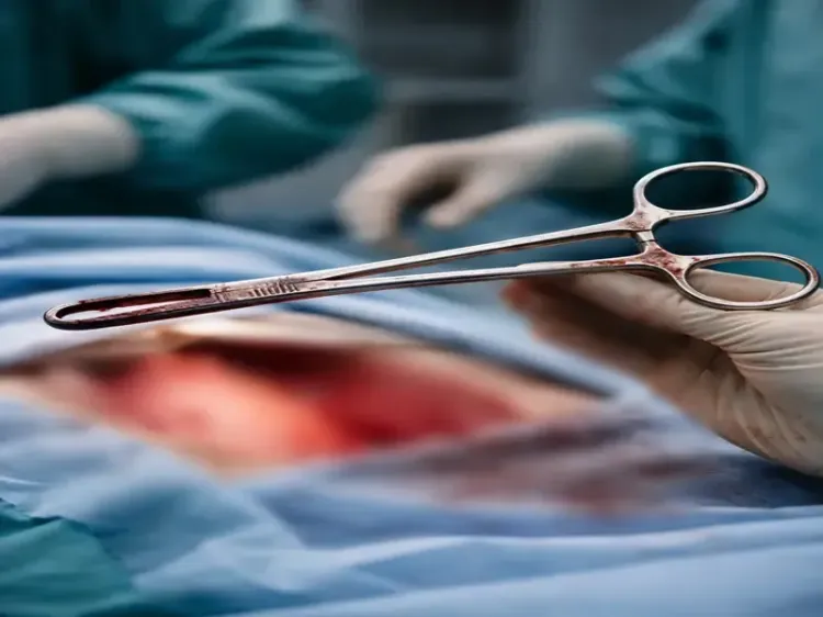 How Was a Surgical Forceps Left Inside a Kerala Woman for Five Years?