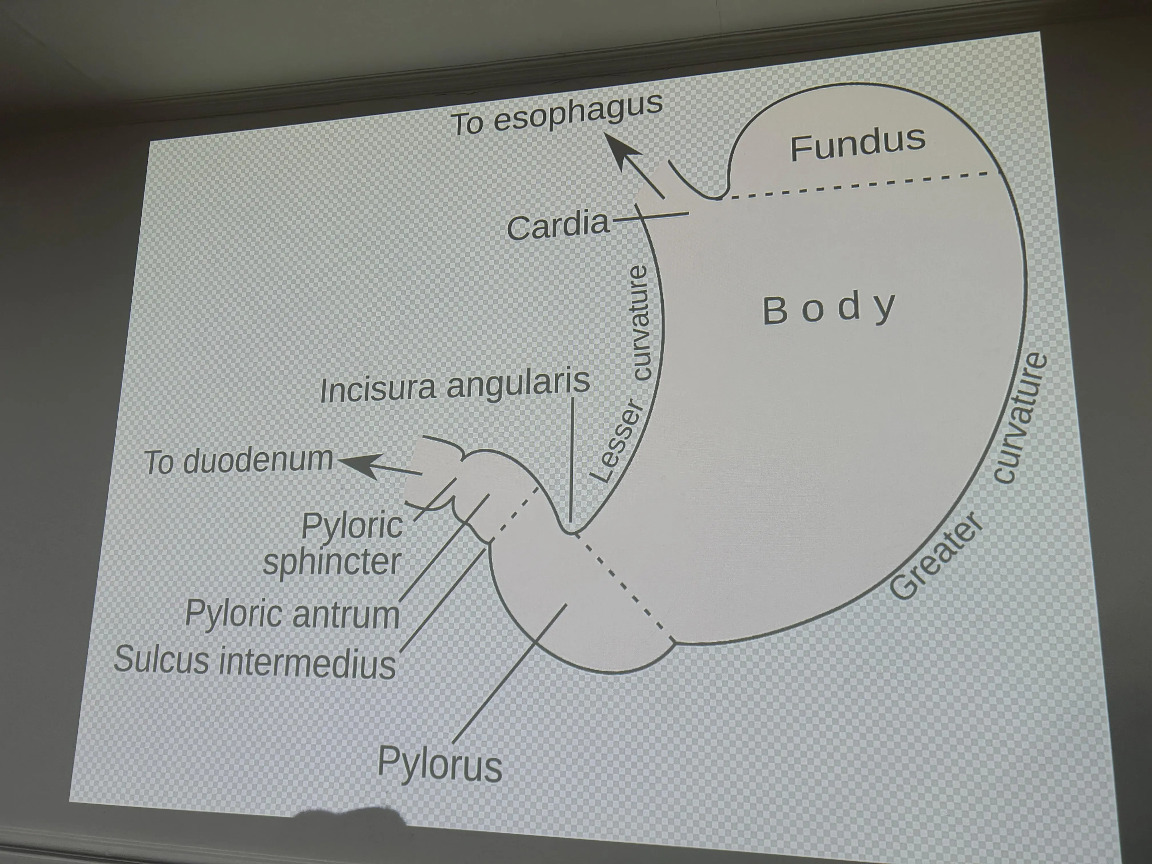 Can Metabolic Surgery Prevent Organ Damage From Uncontrolled Diabetes?