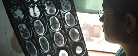 Do More than 1 in 3 People Globally Suffer from Brain Disorders, Leading to 11 Million Deaths Annually?