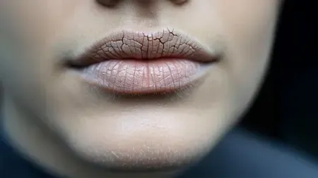 क्या मुंह सूखना सिर्फ डिहाइड्रेशन नहीं, गंभीर रोगों का संकेत भी है? आयुर्वेद से जानें समाधान