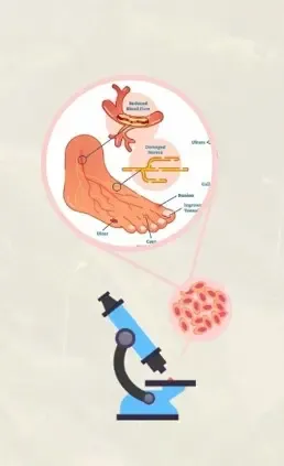 Could Sinapic Acid Be the Key to Healing Diabetic Foot Ulcers?