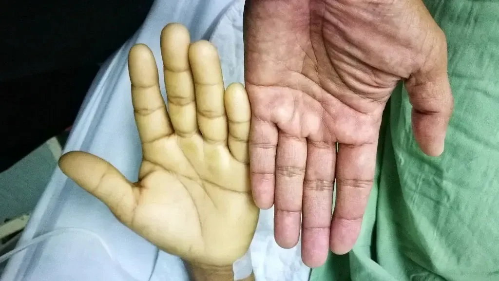 Innovative Research Enhances Anaemia Diagnosis and Forensic Applications