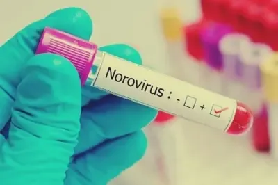 What Caused the Norovirus Infections of Over 100 Students in South China School?