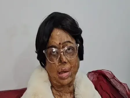 पद्मश्री सम्मान से गदगद एसिड अटैक सर्वाइवर मंगला कपूर बोलीं-पीएम के शब्दों ने हौसला दिया 