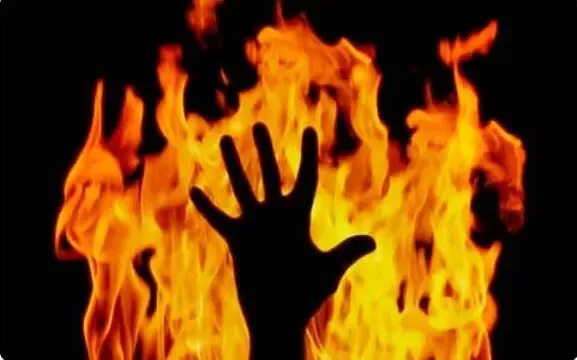 Woman in Karachi Set on Fire by Husband After Objecting to His Affairs