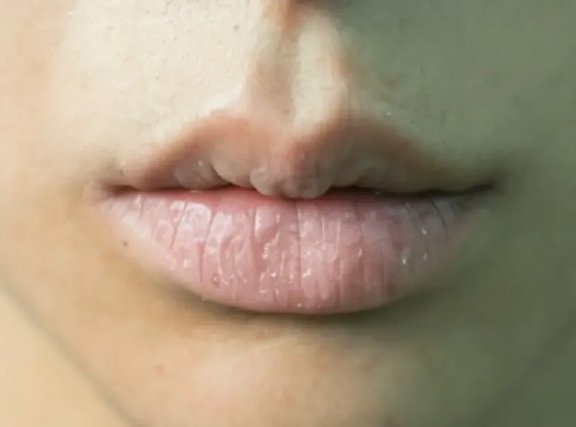 होंठ, झुर्रियों और अन्य समस्याओं के लिए वैसलीन का सही उपयोग कैसे करें?