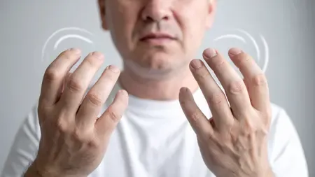 Can Poor Air Quality Lead to Severe Rheumatoid Arthritis?
