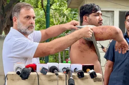 Rahul Gandhi accuses Centre of lying on pellet use in CJP protest