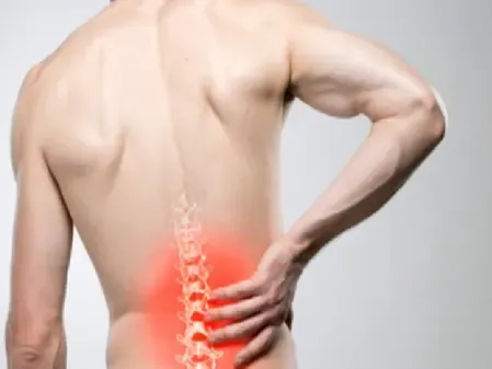 साधारण कमर दर्द हो सकता है स्लिप डिस्क का भी लक्ष्ण, जानें इसका उपचार