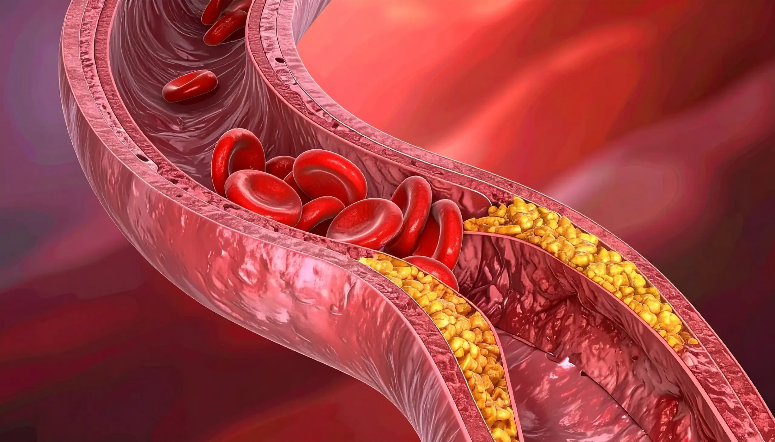 क्या बढ़ता कोलेस्ट्रॉल आपके शरीर के लिए खतरे का संकेत है? आयुर्वेद से जानें उपाय