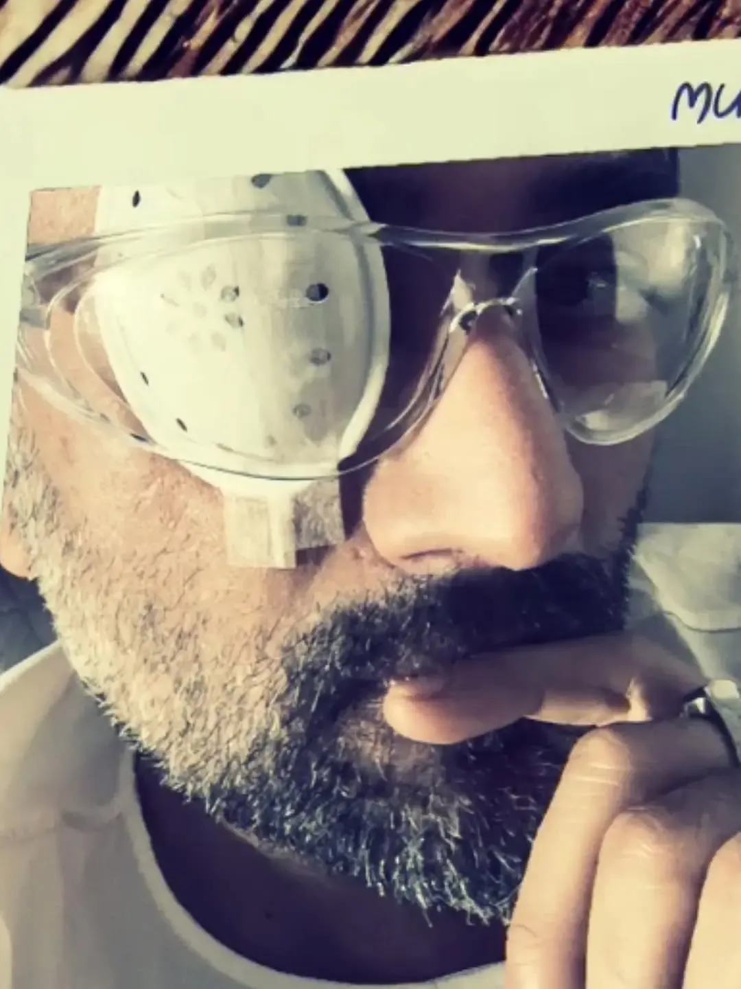 What Did Shekhar Ravjiani Share About His Cataract Struggles?